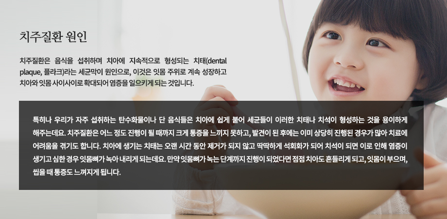 치주질환 원인
치주질환은 음식을 섭취하며 치아에 지속적으로 형성되는 치태(dental plaque, 플라크)라는 세균막이 원인으로, 이것은 잇몸 주위로 계속 성장하고 치아와 잇몸 사이사이로 확대되어 염증을 일으키게 되는 것입니다. 특히나 우리가 자주 섭취하는 탄수화물이나 단 음식들은 치아에 쉽게 붙어 세균들이 이러한 치태나 치석이 형성하는 것을 용이하게 해주는데요. 치주질환은 어느 정도 진행이 될 때까지 크게 통증을 느끼지 못하고, 발견이 된 후에는 이미 상당히 진행된 경우가 많아 치료에 어려움을 겪기도 합니다. 치아에 생기는 치태는 오랜 시간 동안 제거가 되지 않고 딱딱하게 석회화가 되어 치석이 되면 이로 인해 염증이 생기고 심한 경우 잇몸뼈가 녹아 내리게 되는데요. 만약 잇몸뼈가 녹는 단계까지 진행이 되었다면 점점 치아도 흔들리게 되고, 잇몸이 부으며, 씹을 때 통증도 느껴지게 됩니다.
