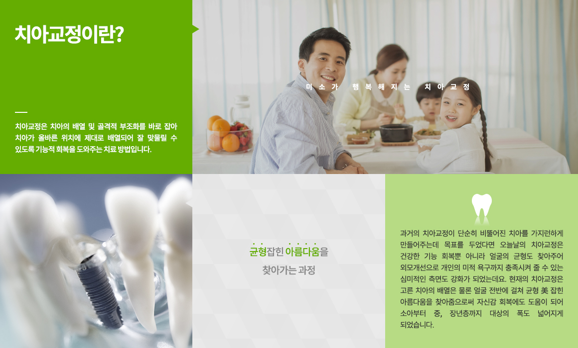 Orthodontic treatment
<균형의 美> 
미소가 행복해지는 CORE 치과 치아교정

치아교정은 치아의 배열 및 골격적 부조화를 바로 잡아 치아가 올바른 위치에 제대로 배열되어 잘 맞물릴 수 있도록 기능적 회복을 도와주는 치료 방법입니다. 
과거의 치아교정이 단순히 비뚤어진 치아를 가지런하게 만들어주는데 목표를 두었다면 오늘날의 치아교정은 건강한 기능 회복뿐 아니라 얼굴의 균형도 찾아주어 외모개선으로 개인의 미적 욕구까지 충족시켜 줄 수 있는 심미적인 측면도 강화가 되었는데요. 현재의 치아교정은 고른 치아의 배열은 물론 얼굴 전반에 걸쳐 균형 美 잡힌 아름다움을 찾아줌으로써 자신감 회복에도 도움이 되어 소아부터 중, 장년층까지 대상의 폭도 넓어지게 되었습니다.
