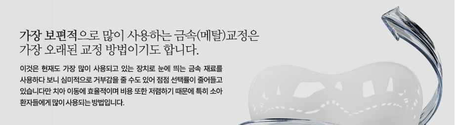 가장 보편적으로 많이 사용하는 금속(메탈)교정은 가장 오래된 교정 방법이기도 합니다. 이것은 현재도 가장 많이 사용되고 있는 장치로 눈에 띄는 금속 재료를 사용하다 보니 심미적으로 거부감을 줄 수도 있어 점점 선택률이 줄어들고 있습니다만 치아 이동에 효율적이며 비용 또한 저렴하기 때문에 특히 소아 환자들에게 많이 사용되는 방법입니다.

