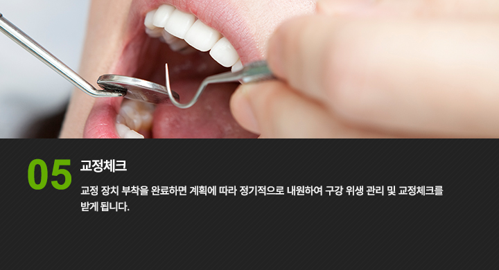 Step 05. 교정체크
교정 장치 부착을 완료하면 계획에 따라 정기적으로 내원하여 구강 위생 관리 및 교정체크를 받게 됩니다.
